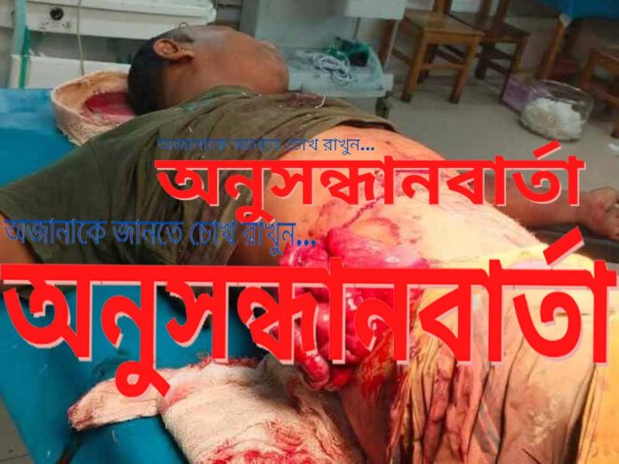 ধুনটে পূজা মণ্ডপ এলাকায় ছুরিকাঘাতে যুবক আহত, আইসিইউতে ভর্তি